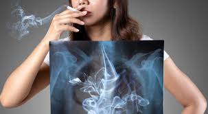 Mengenal Alasan Bahayanya Ngerokok Dan Tips Dalam Berhenti Dalam Merokok